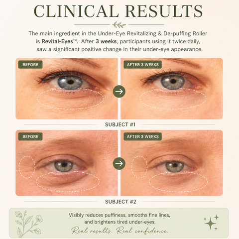 Under-Eye Revitalizing & De-puffing Roller