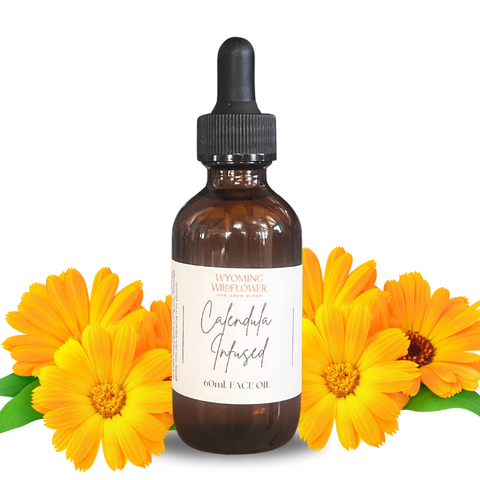 Calendula Infused Facial Oil- Acne, Psoriasis, Eczema