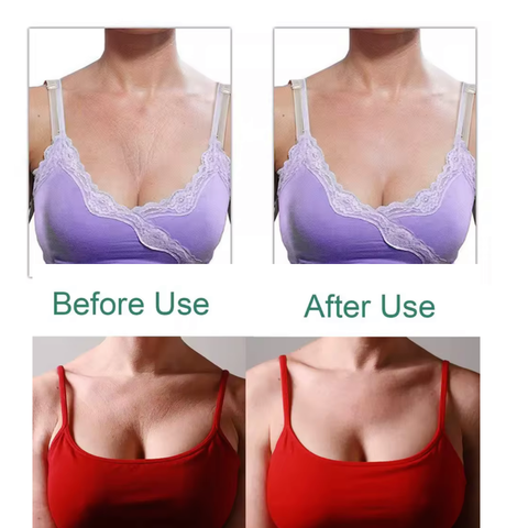 Anti-Wrinkle Chest Pads- Medical Grade Silicone (2-Pack | 1-Month Supply)