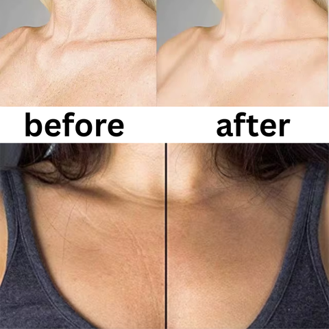 Anti-Wrinkle Chest Pads- Medical Grade Silicone (2-Pack | 1-Month Supply)