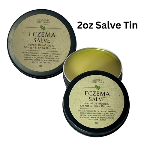 Eczema Salve