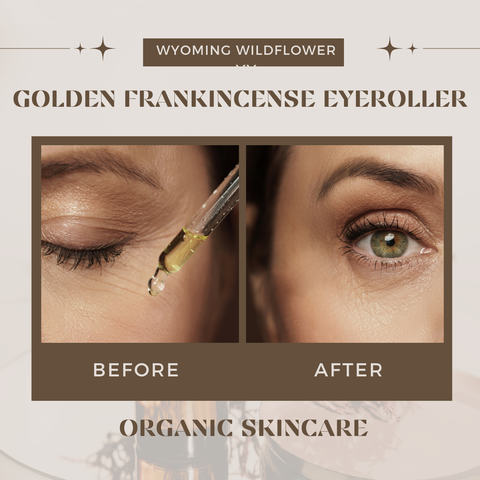 Golden Frankincense Tears Under Eye Treatment