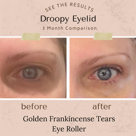 Golden Frankincense Tears Under Eye Treatment