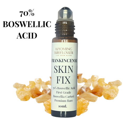 Frankincense Skin Fix with 70% Boswellic Acid