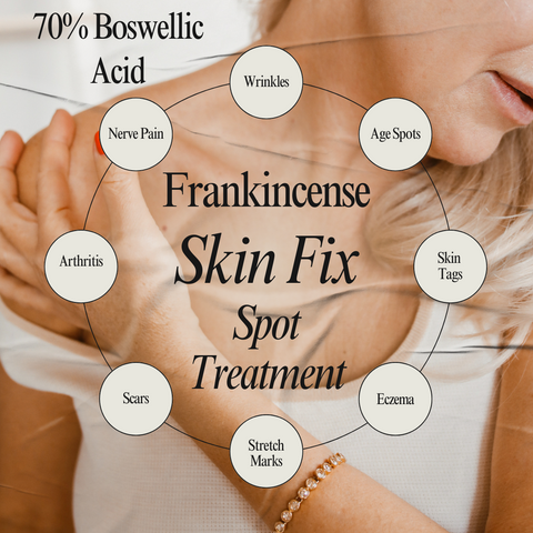 Frankincense Skin Fix with 70% Boswellic Acid